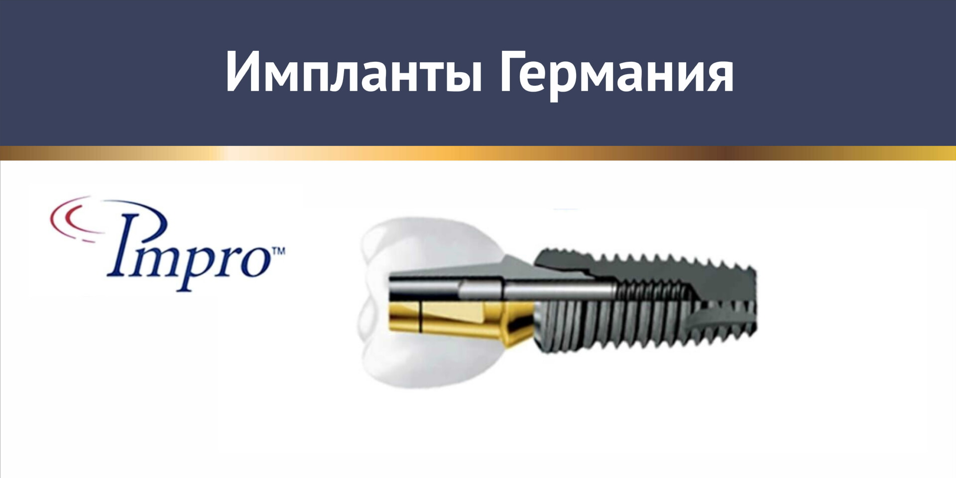 Импланты Impro Германия