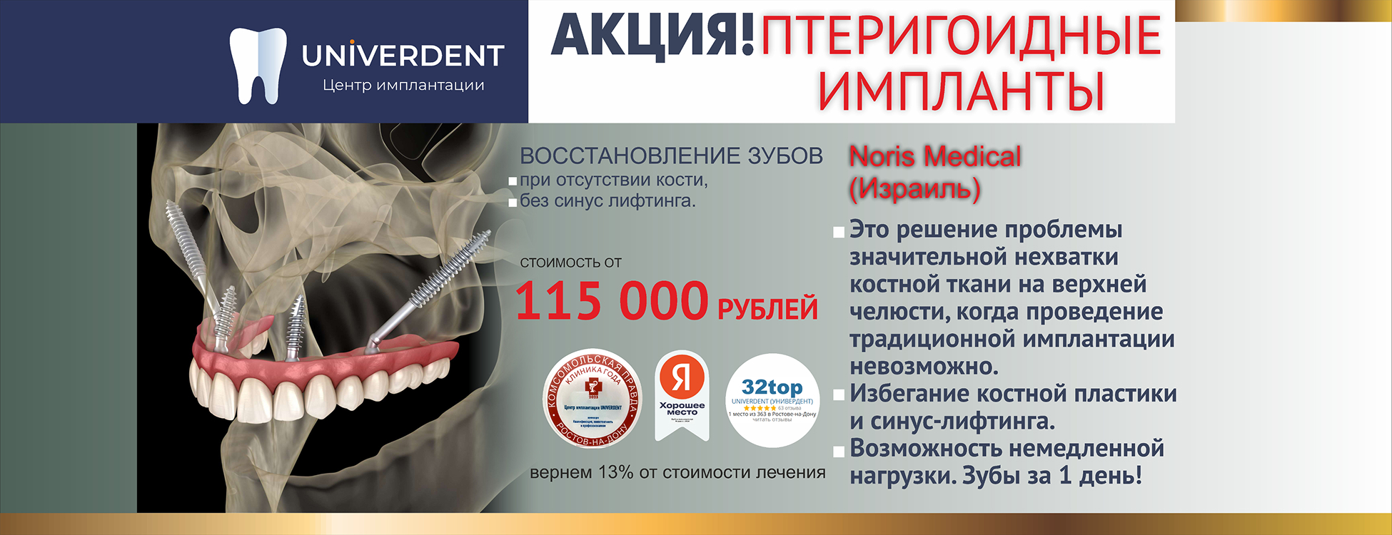 Акция: Установка птеригоидных имплантов