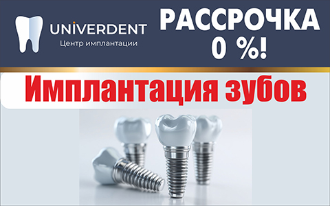 Имплантация зубов