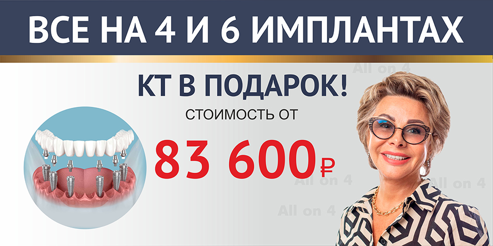 «Всё на 4»: имплантация «под ключ» 