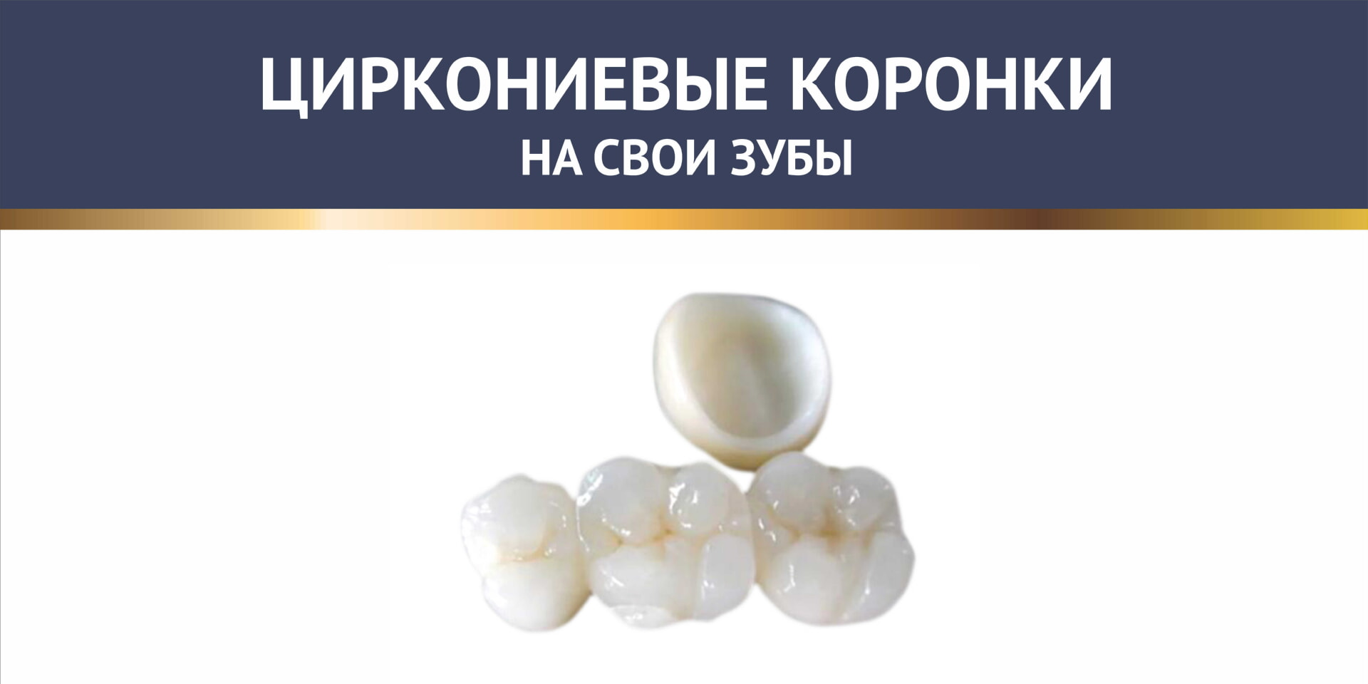 Протезирование на своих зубах - Циркониевые коронки