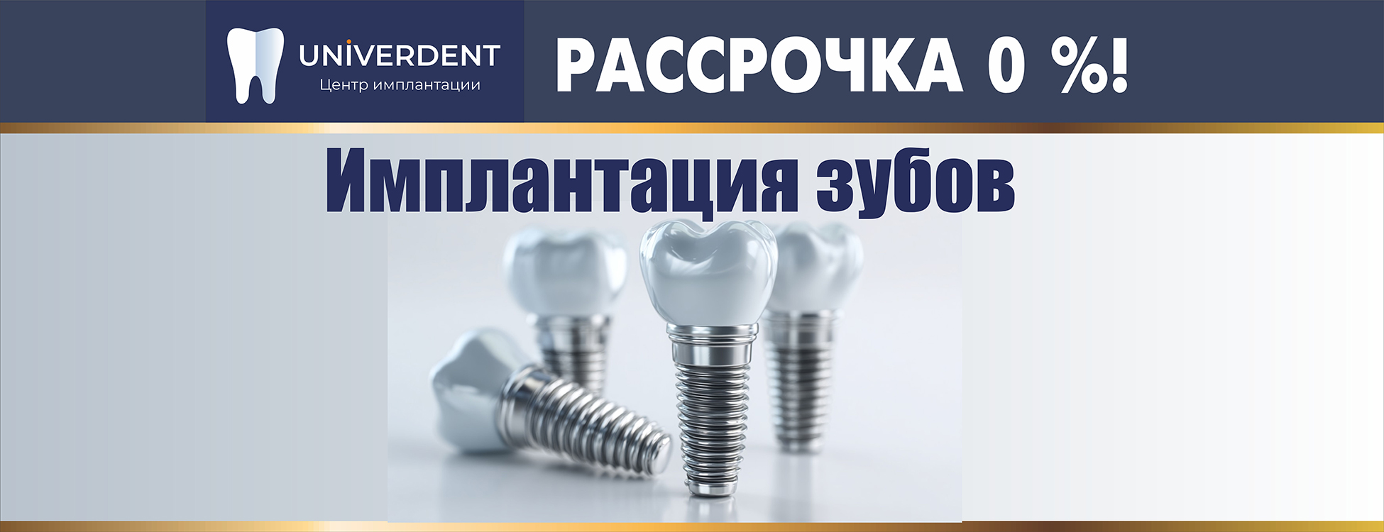 Имплантация зубов