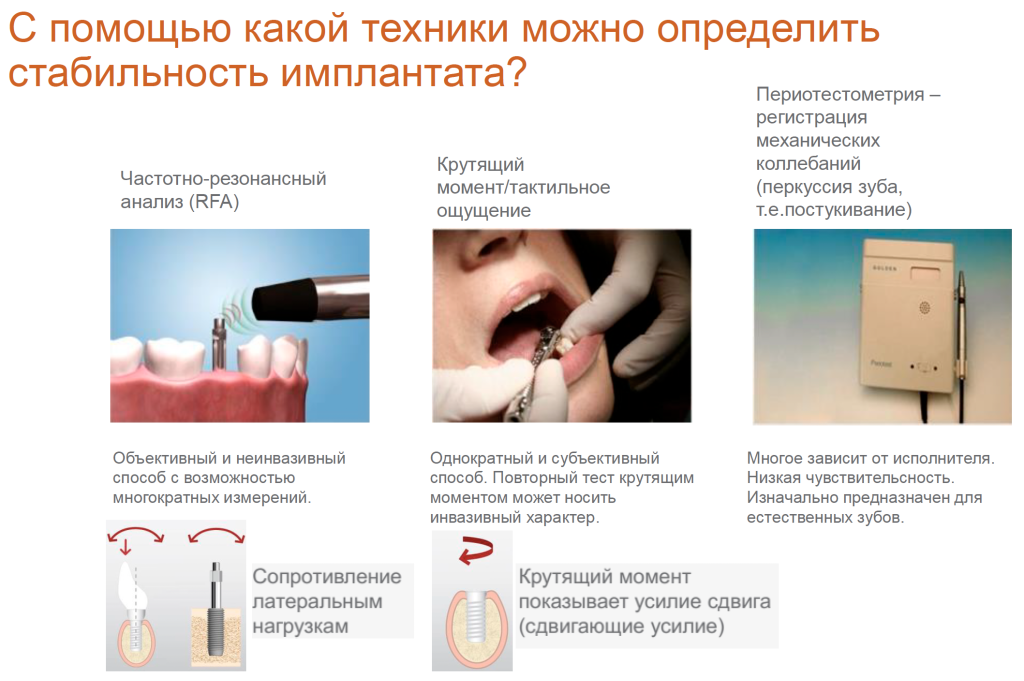 Техники определения микроподвижности импланта.