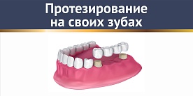 Протезирование на своих зубах