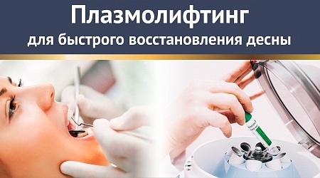 Плазмолифтинг  в стоматологии