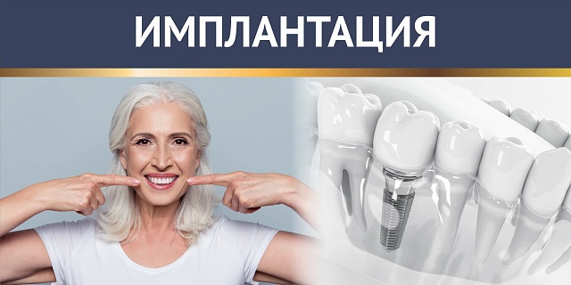 Системы имплантации