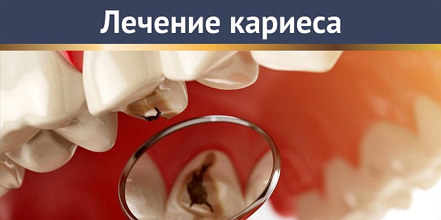 Лечение кариеса