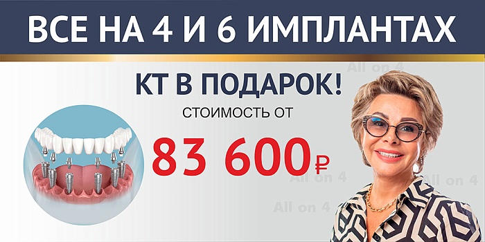 «Всё на 4»: имплантация «под ключ» 