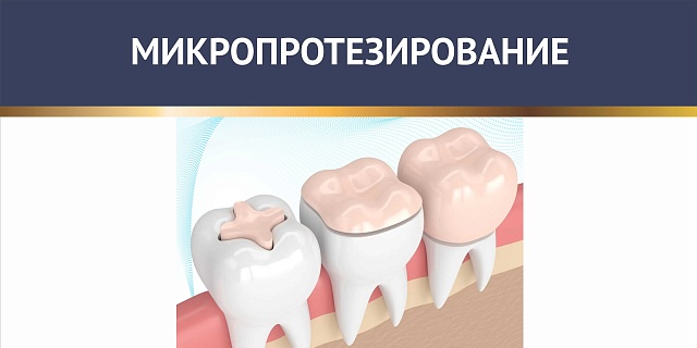 Микропротезирование