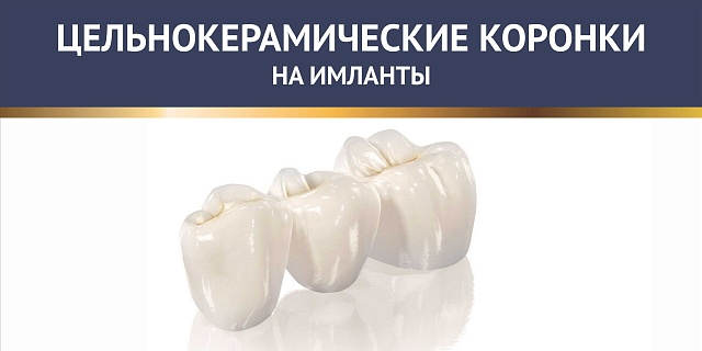 Цельнокерамические коронки